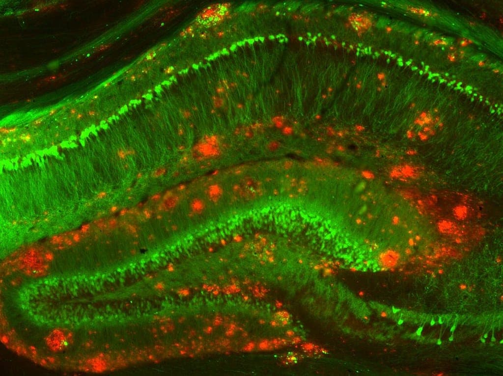 Mouse model of Alzheimer’s disease