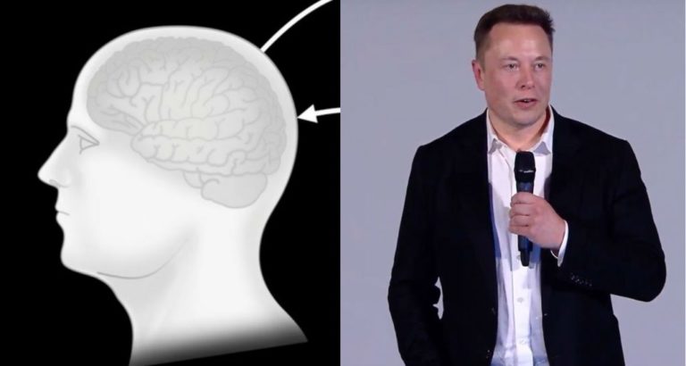 Neuralink Progress update summer 2020