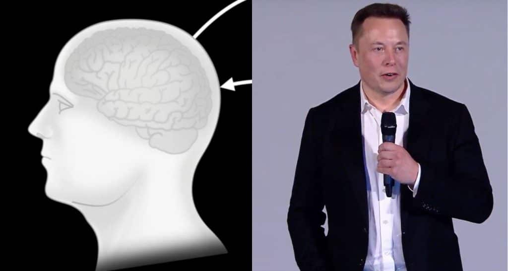 Watch The Neuralink Progress Update Summer 2020 (as it happened) 1 Neuralink Progress update summer 2020
